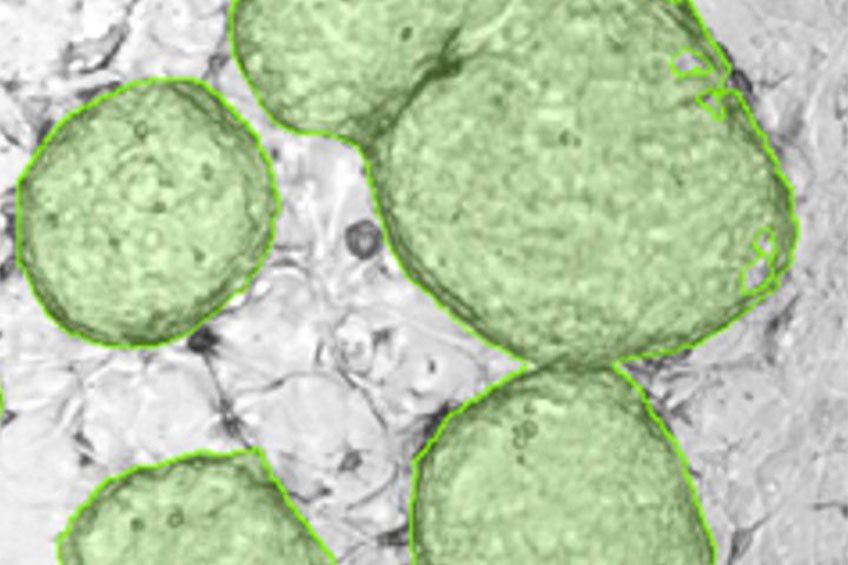 Cloning to Fight Esophageal Cancer